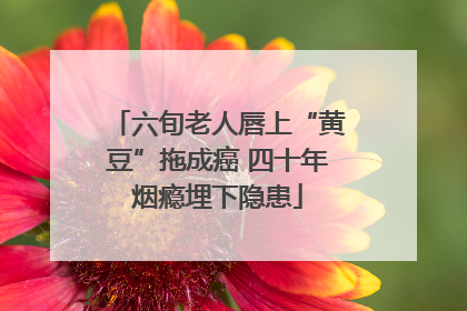 六旬老人唇上“黄豆”拖成癌 四十年烟瘾埋下隐患
